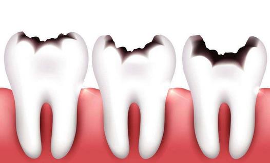 牙齿衰老的症状你知道么?