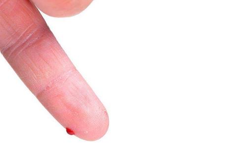 身体出现这些症状说明你需要查血糖了!