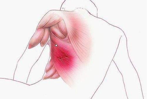 软组织挫伤多久能好?