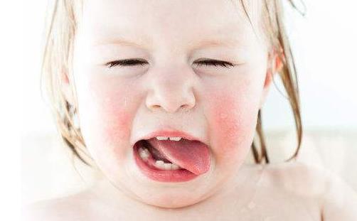 什么是蛲虫病?蛲虫的症状有哪些